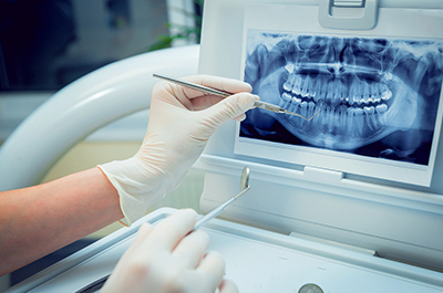 dental-xrays